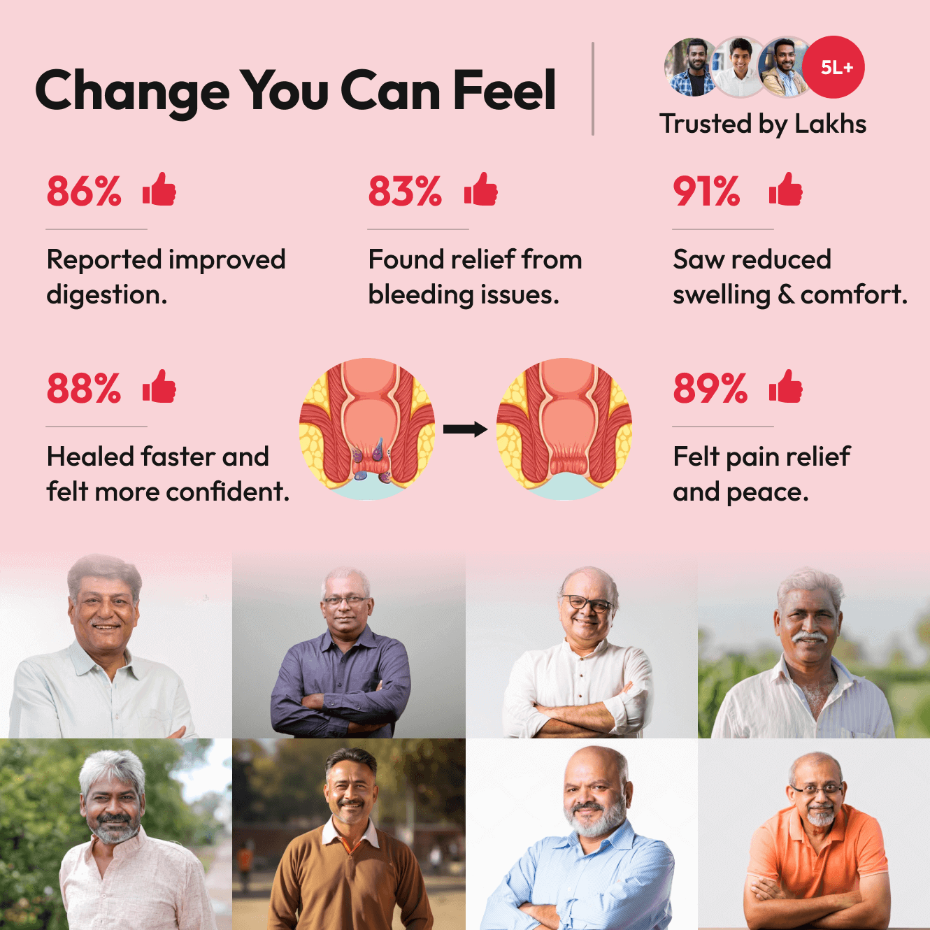 Dr Mantra Piles Care