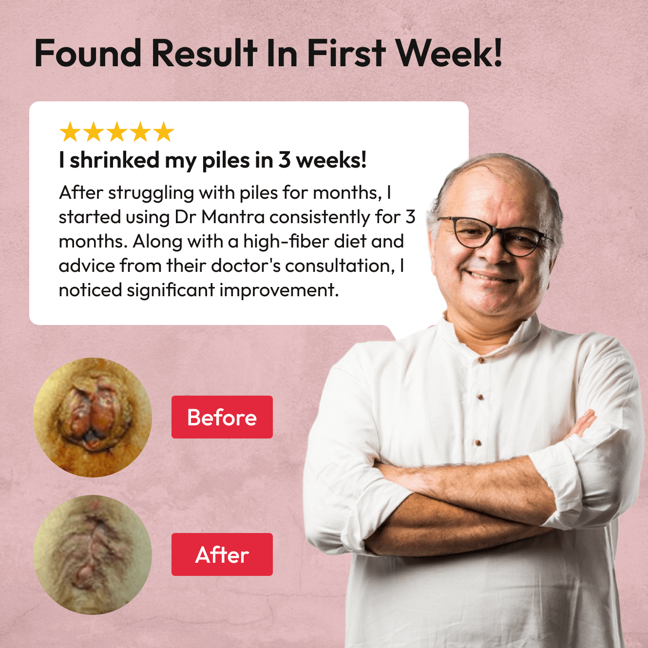 Dr Mantra Piles Care