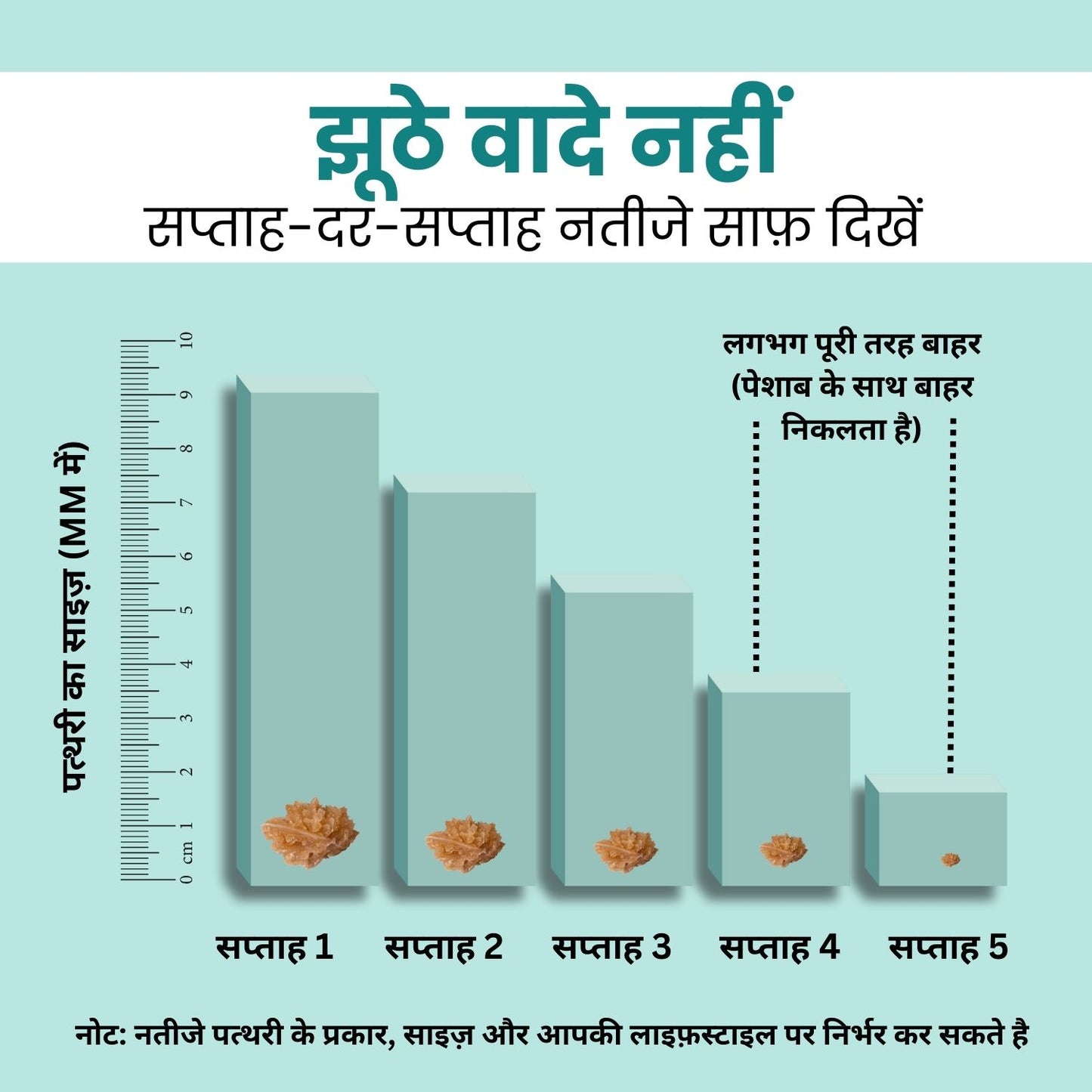 Kidney Stone Crusher Juice (Free Diet Chart & Ayurveda Expert Consultation )