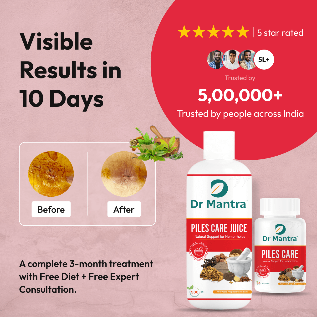 Dr Mantra Piles Care