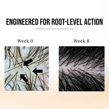 Dr Mantra Anti Hair Fall Combo