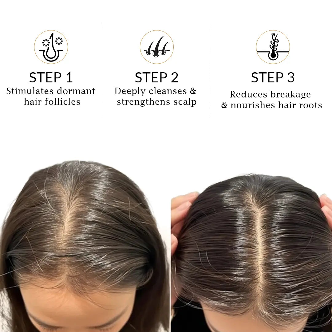 Dr Mantra Anti Hair Fall Combo