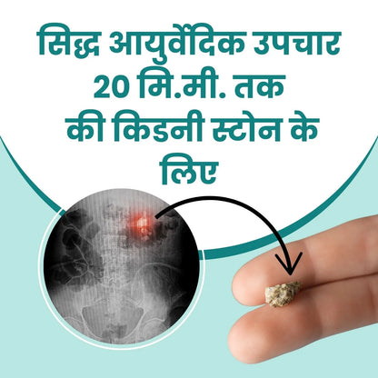 Kidney Stone Crusher Juice (Free Diet Chart & Ayurveda Expert Consultation )