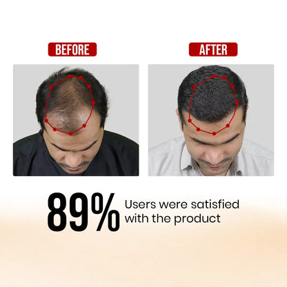 Dr Mantra Anti Hair Fall Combo