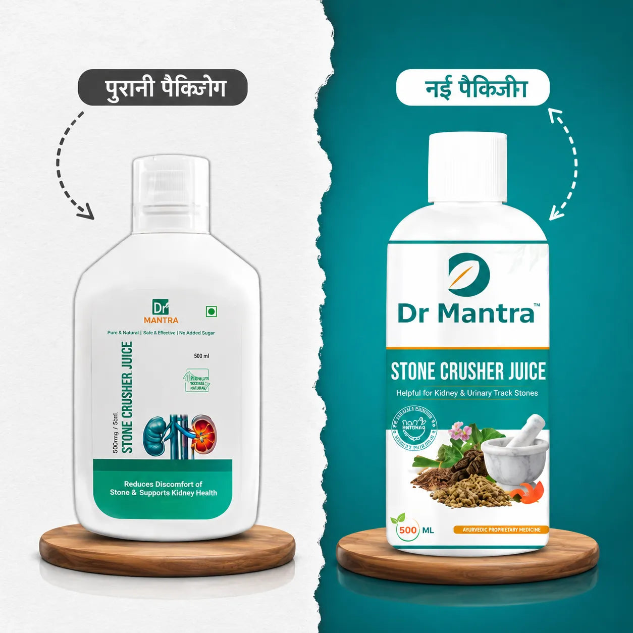 Kidney Stone Crusher Combo (Free Diet Chart & Ayurveda Expert Consultation )