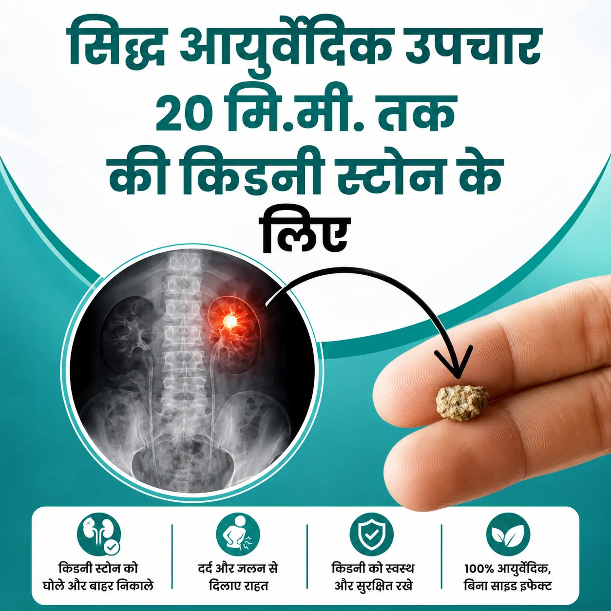 Kidney Stone Crusher Combo (Free Diet Chart & Ayurveda Expert Consultation )