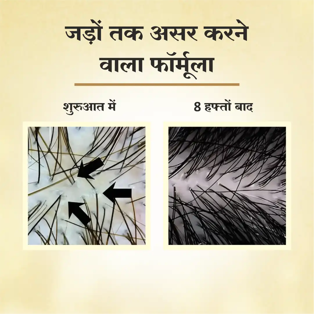 Dr Mantra Anti Hair Fall Combo