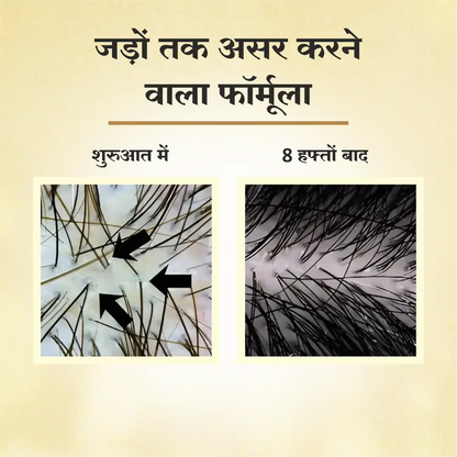 Dr Mantra Anti Hair Fall Combo