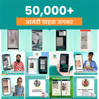 किडनी स्टोन क्रशर ज्यूस (फ्री डायट चार्ट व आयुर्वेदा एक्स्पर्ट कन्सल्टेशन)