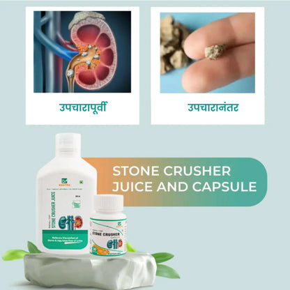 किडनी स्टोन क्रशर ज्यूस (फ्री डायट चार्ट व आयुर्वेदा एक्स्पर्ट कन्सल्टेशन)
