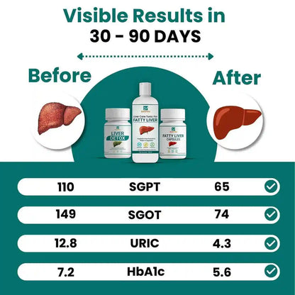 Say goodbye to fatty liver in few weeks + diet chart + doctor consultation (FREE)